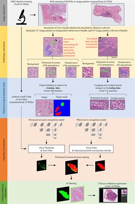A domain knowledge enhanced yield based deep learning classifier identifies perineural invasion in oral cavity squamous cell carcinoma